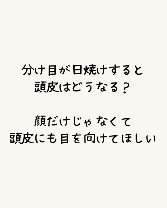 分け目が日焼けすると頭皮はどうなる？顔だけじゃなくて頭皮にも目を向けてほしい